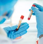 Alzheimer's Blood Test Closer