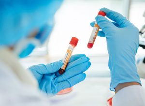 Alzheimer's Blood Test Closer