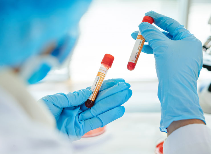 Alzheimer's Blood Test Closer